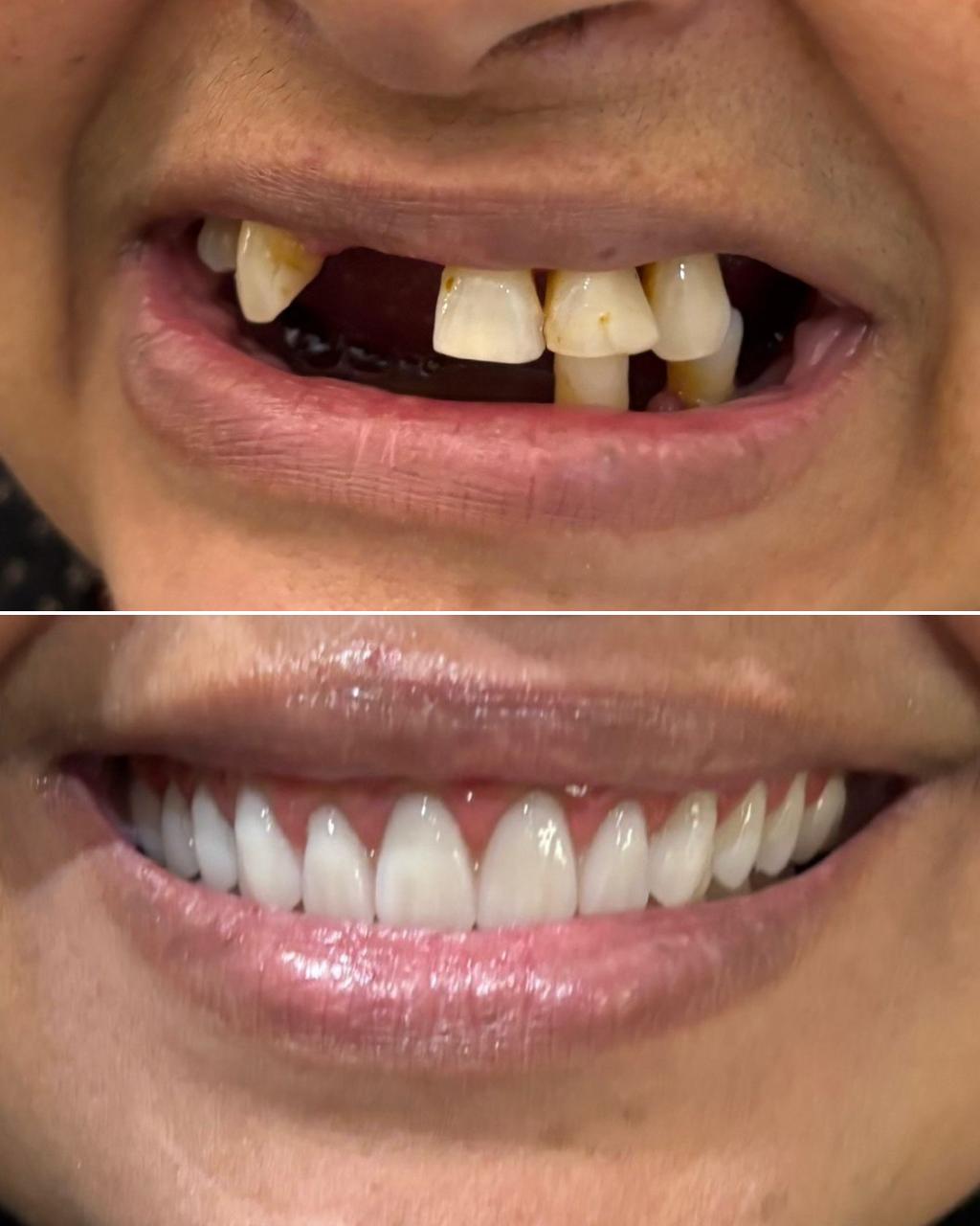 Resultado Clínico 1